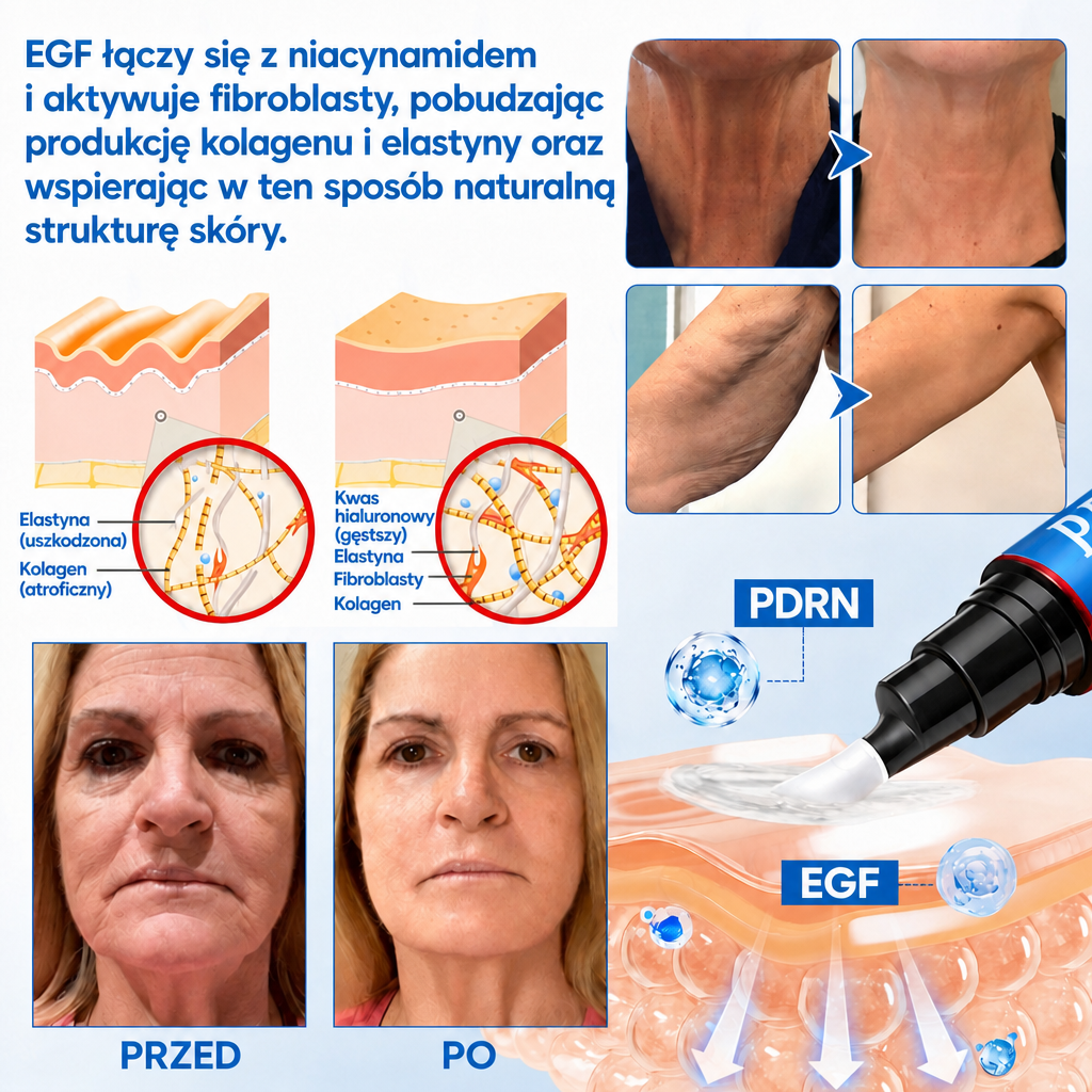 Celsiora® Botox & PDRN przeciw zmarszczkom – krem liftingujący i ujędrniający🧡🧡