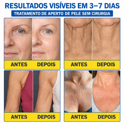 Celsiora® Botox & PDRN Shot Antirrugas – Creme de Lifting e Firmeza❤❤
