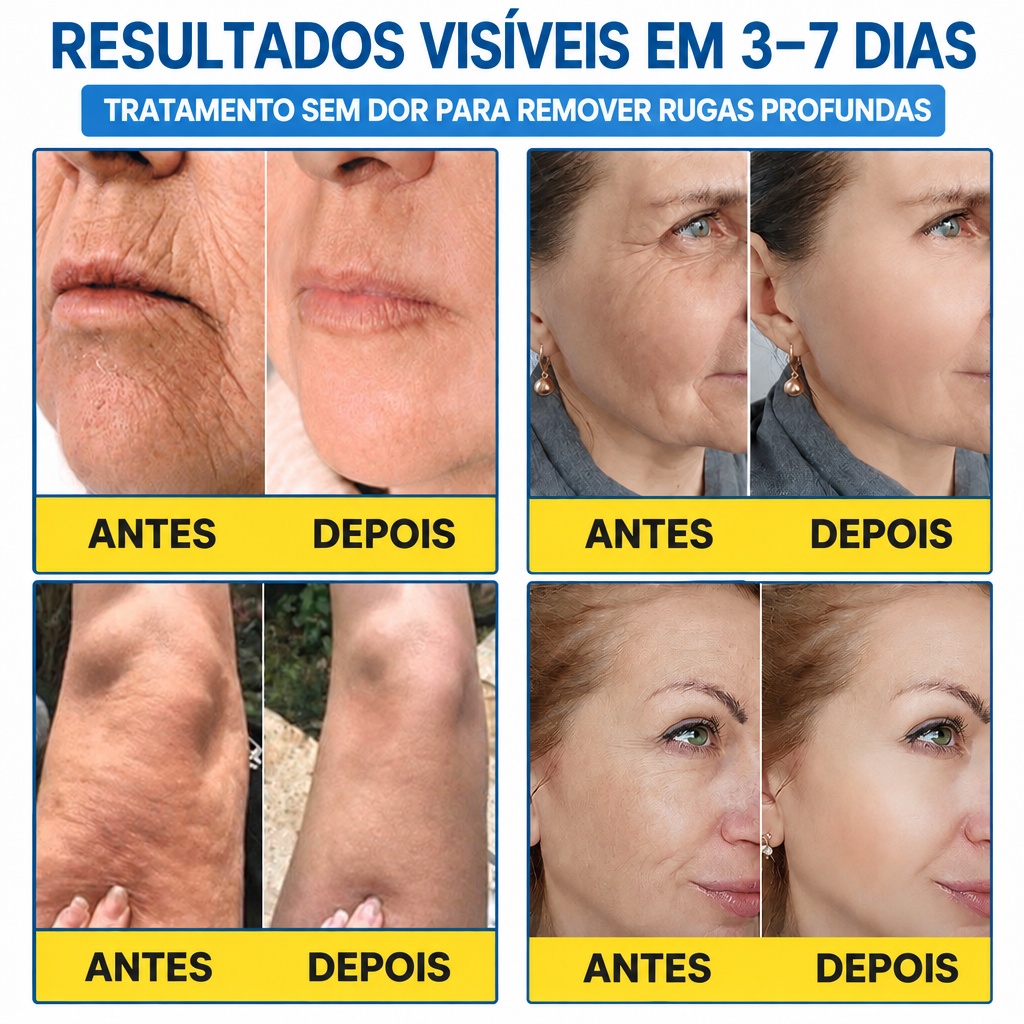 Celsiora® Botox & PDRN Shot Antirrugas – Creme de Lifting e Firmeza❤❤
